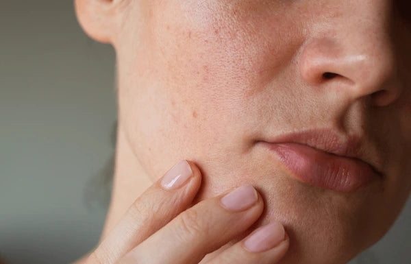 Sensitive Skin